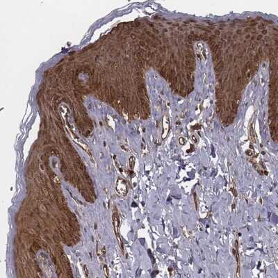 Immunocytochemistry/ Immunofluorescence: RPL3 Antibody [NBP2-68717]