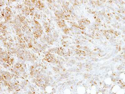 Immunohistochemistry-Paraffin: RPL3 Antibody [NBP2-20214]
