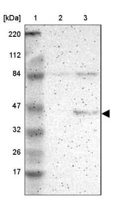 Western Blot: RPL3 Antibody [NBP1-81332]