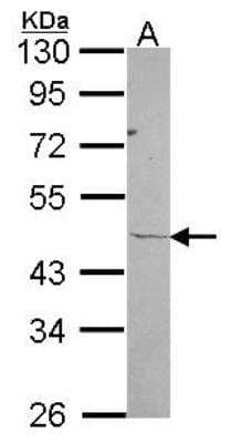 Western Blot: RPL3 Antibody [NBP2-20213]