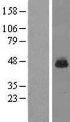 Western Blot: RPL3 Overexpression Lysate [NBL1-15523]