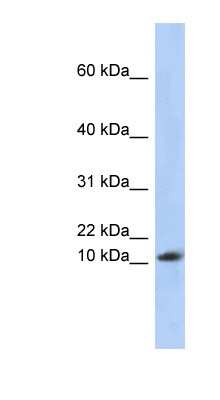 Western Blot: RPL30 Antibody [NBP1-52873]