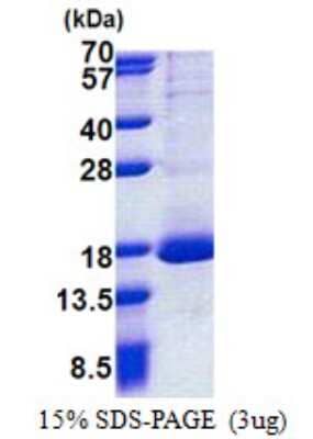 SDS-PAGE: Recombinant Human RPL30 His Protein [NBP2-23423]