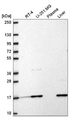 Western Blot: RPL31 Antibody [NBP2-58847]