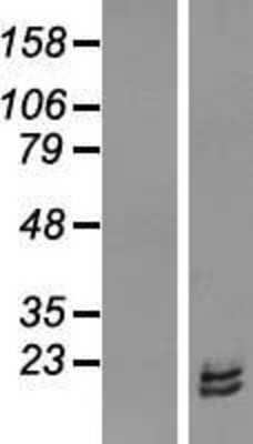 Western Blot: RPL31 Overexpression Lysate [NBL1-15525]