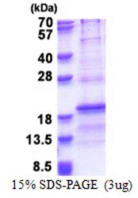 SDS-PAGE: Recombinant Human RPL31 His Protein [NBP2-23424]