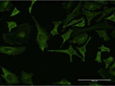 Immunocytochemistry/ Immunofluorescence: RPL32 Antibody (1B11) [H00006161-M04]