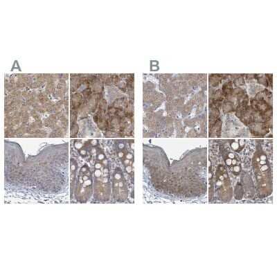 Immunohistochemistry-Paraffin: RPL32 Antibody [NBP2-30682]