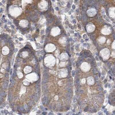 Immunohistochemistry-Paraffin: RPL32 Antibody [NBP2-30682]