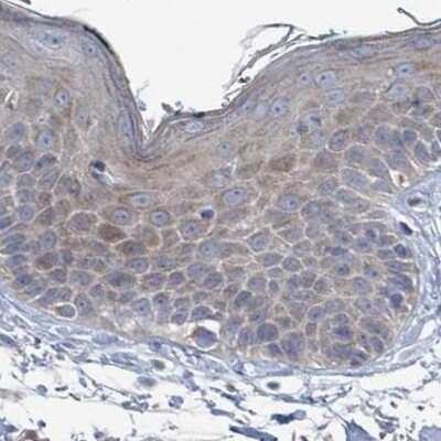 Immunohistochemistry-Paraffin: RPL32 Antibody [NBP2-30682]