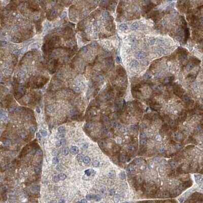 Immunohistochemistry-Paraffin: RPL32 Antibody [NBP2-48874]