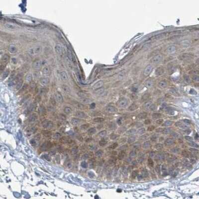 Immunohistochemistry-Paraffin: RPL32 Antibody [NBP2-48874]