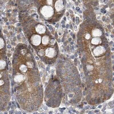 Immunohistochemistry-Paraffin: RPL32 Antibody [NBP2-48874]