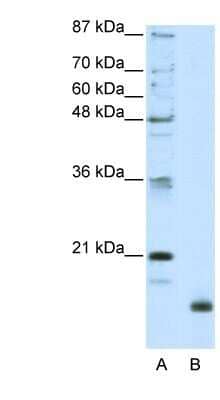 Western Blot: RPL32 Antibody [NBP1-80442]