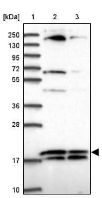 Western Blot: RPL32 Antibody [NBP2-48874]