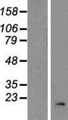 Western Blot: RPL32 Overexpression Lysate [NBP2-09116]