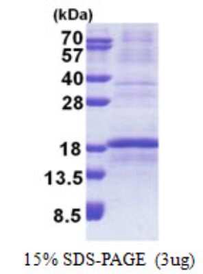 SDS-PAGE: Recombinant Human RPL34 His Protein [NBP2-23425]