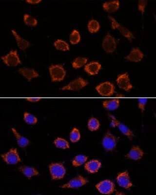Immunocytochemistry/ Immunofluorescence: RPL35 Antibody - Azide and BSA Free [NBP3-15546]
