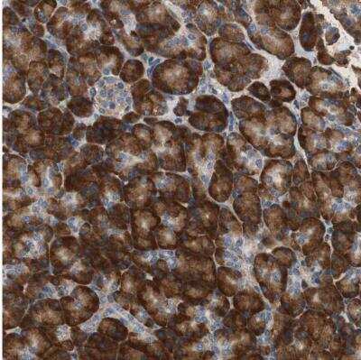Immunohistochemistry-Paraffin: RPL35 Antibody [NBP1-81330]