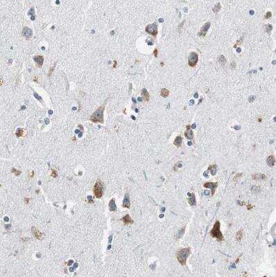 Immunohistochemistry-Paraffin: RPL35 Antibody [NBP1-81330]