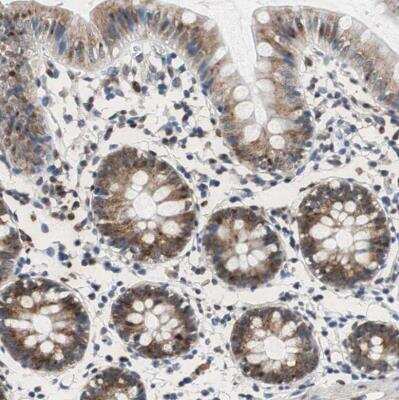 Immunohistochemistry-Paraffin: RPL35 Antibody [NBP1-81330]