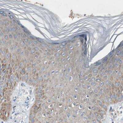 Immunohistochemistry-Paraffin: RPL35 Antibody [NBP1-81330]