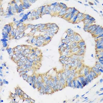 Immunohistochemistry-Paraffin: RPL35 Antibody - Azide and BSA Free [NBP3-15546]