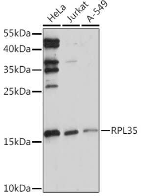 Western Blot: RPL35 AntibodyAzide and BSA Free [NBP3-15546]