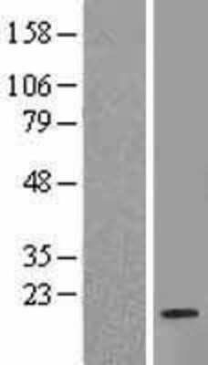 Western Blot: RPL35 Overexpression Lysate [NBL1-15530]