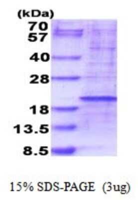 SDS-PAGE: Recombinant Human RPL35 His Protein [NBP2-51847]