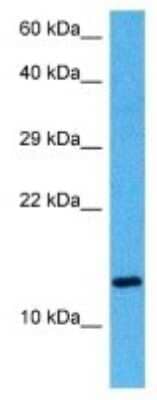 Western Blot: RPL35A Antibody [NBP3-10041]