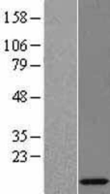 Western Blot: RPL35A Overexpression Lysate [NBL1-15531]