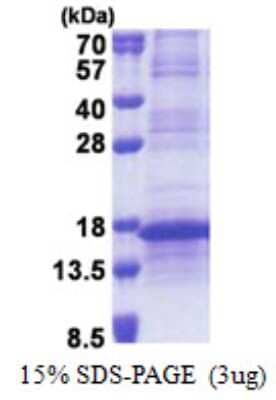 SDS-PAGE: Recombinant Human RPL35A His Protein [NBP2-23426]