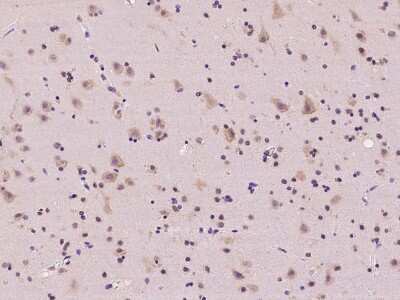 Immunohistochemistry-Paraffin: RPL36 Antibody [NBP2-97618]