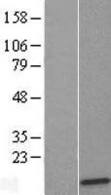 Western Blot: RPL36 Overexpression Lysate [NBL1-15532]