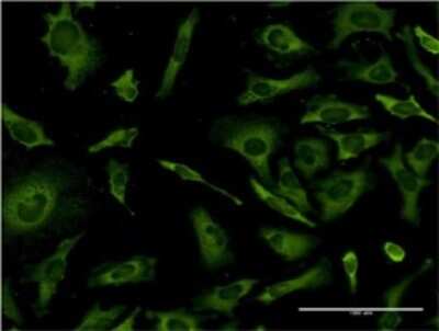 Immunocytochemistry/ Immunofluorescence: RPL36A Antibody (5F8) [H00006173-M01]