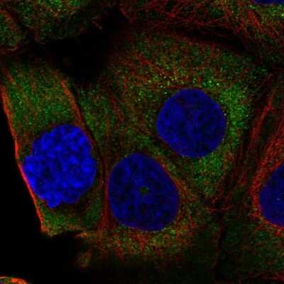 Immunocytochemistry/ Immunofluorescence: RPL36A Antibody [NBP2-57883]