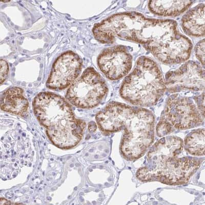 Immunohistochemistry-Paraffin: RPL36A Antibody [NBP2-38036]