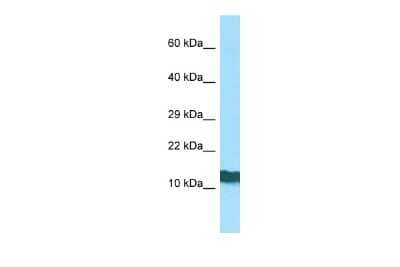 Western Blot: RPL36AL Antibody [NBP3-09484]