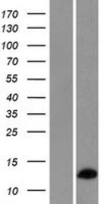 Western Blot: RPL36AL Overexpression Lysate [NBP2-08940]