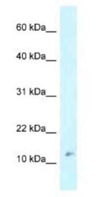 Western Blot: RPL37 Antibody [NBP1-79912]