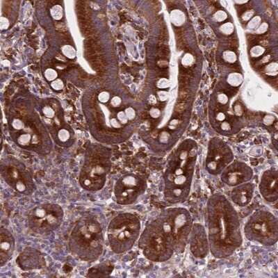 Immunohistochemistry-Paraffin: RPL37A Antibody [NBP2-49441]
