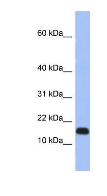 Western Blot: RPL37A Antibody [NBP1-55204]