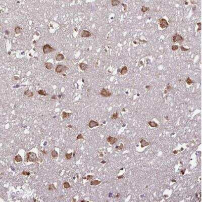 Immunohistochemistry: RPL38 Antibody [NBP2-30693]