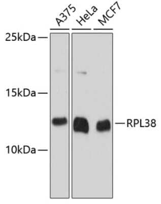 Western Blot: RPL38 AntibodyAzide and BSA Free [NBP2-93762]