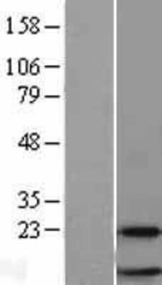 Western Blot: RPL38 Overexpression Lysate [NBL1-15535]