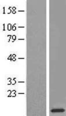 Western Blot: RPL38 Overexpression Lysate [NBL1-15536]