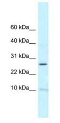 Western Blot: RPL39 Antibody [NBP1-79926]