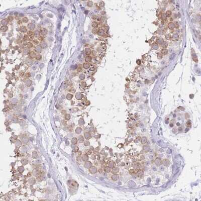 Immunohistochemistry-Paraffin: RPL39L Antibody [NBP2-13256]