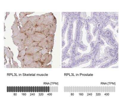 Immunohistochemistry-Paraffin: RPL3L Antibody [NBP2-13257]